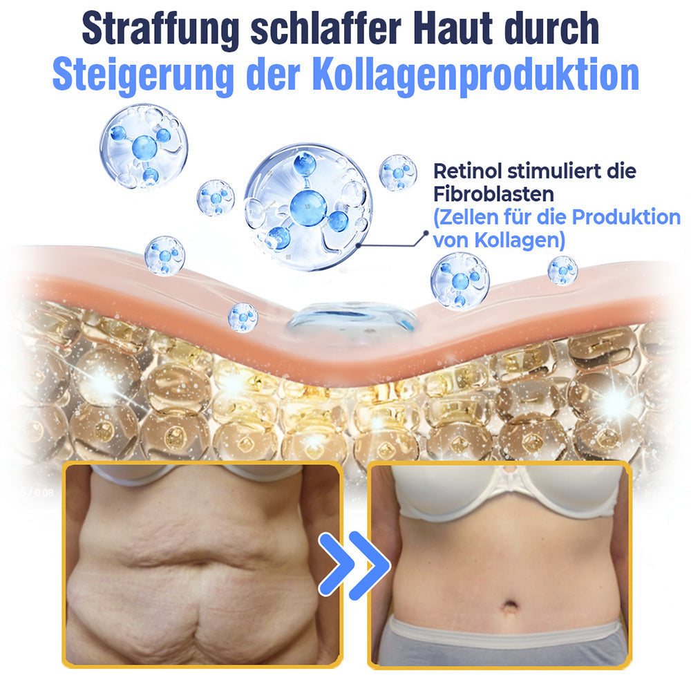 đ¸flysmus⢠Erweiterte straffende & faltenreduzierende Lotion