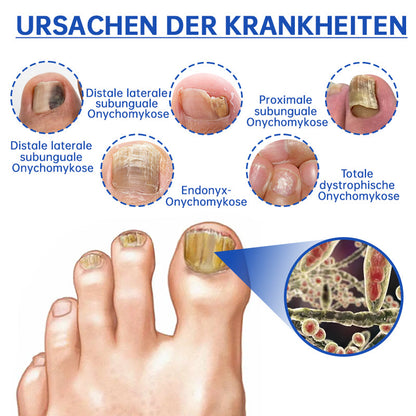 Furzero™ Pure-Nail Pilz-Lasertherapiegerät