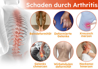 Furzero™ Arthritis-Creme (Nacken & Zurück & Knie-Relief)