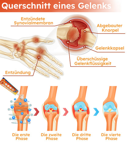 Furzero™ Arthritis Creme (Nacken & Zurück & Knie-Relief)