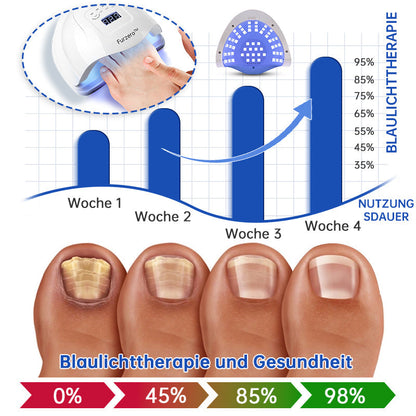 Furzero™ Pure-Nail Pilz-Lasertherapiegerät