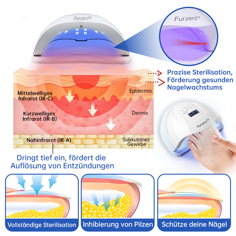 Furzero™ Pure-Nail Pilz-Lasertherapiegerät