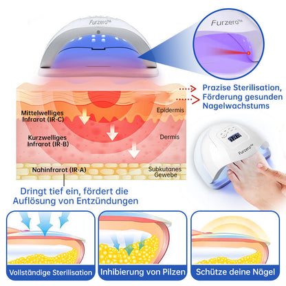 Furzero™ Pure-Nail Pilz-Lasertherapiegerät