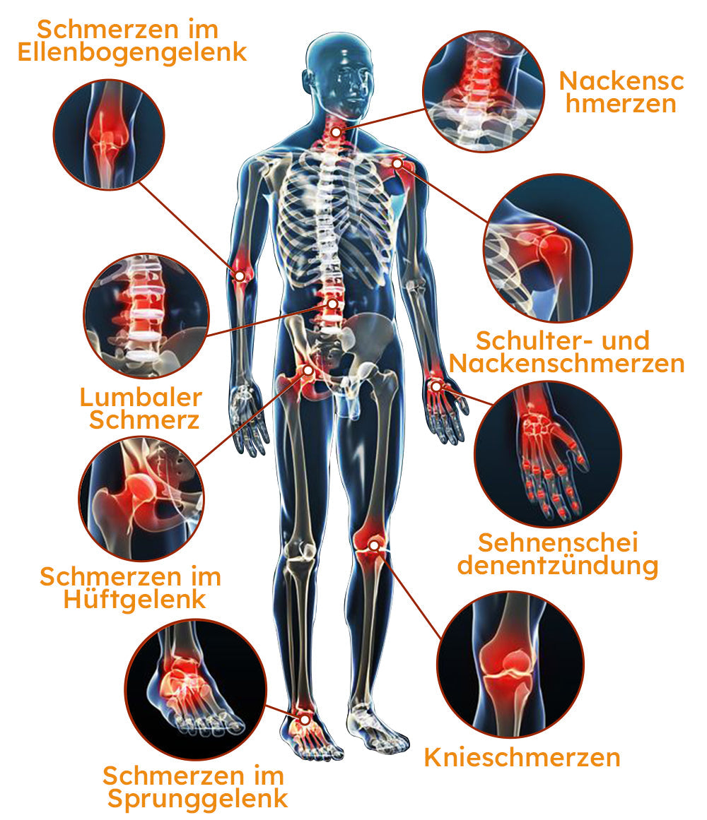 Furzero™ Arthritis-Creme (Nacken & Zurück & Knie-Relief)