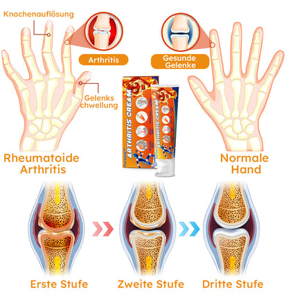 Furzero™ Arthritis-Creme (Nacken & Zurück & Knie-Relief)