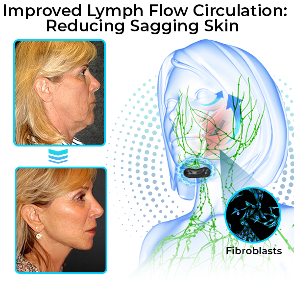 GFOUK™ EMSculpt Schlafendes V-Gesicht Schönheitsgerät