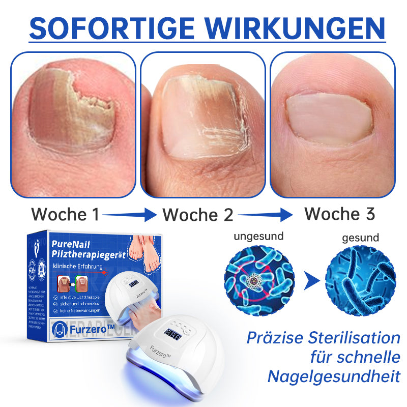 Furzero™ PureNail Pilz-Lasertherapiegerät