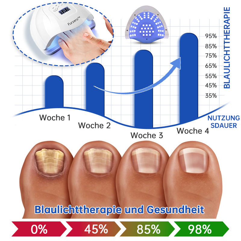 Furzero™ PureNail Pilz-Lasertherapiegerät